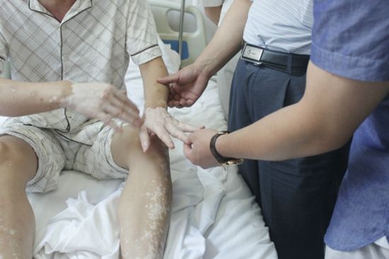 白癜风. 白癜风.jpg